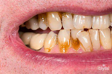 DentalDiseases:PainfulProblemsNeedingPromptCare